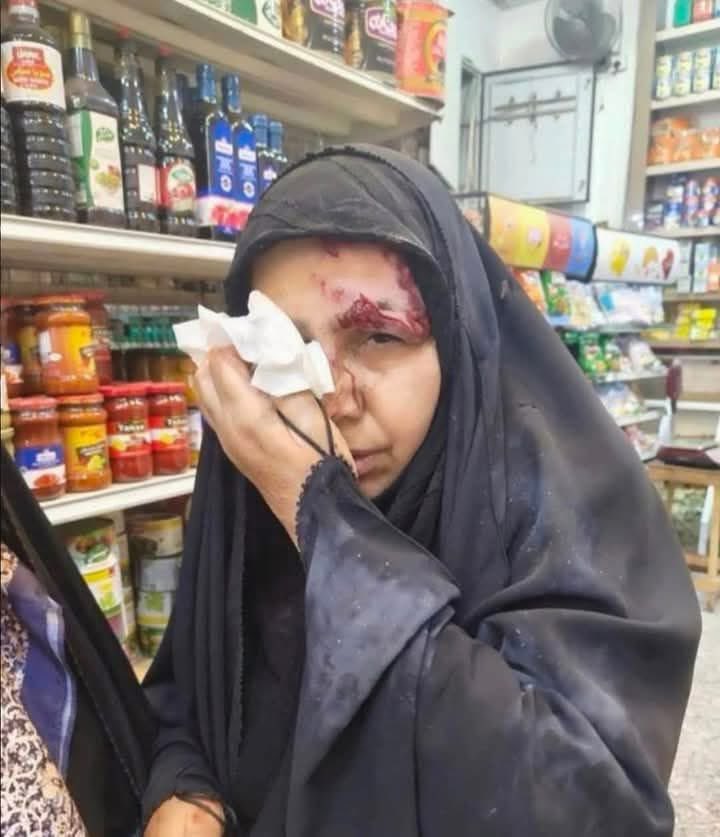 AltaiDeena's tweet photo. 🚨#اضراب_المعلمين 

شُلت أياديكم… “كاد المعلّم أن يكون رسولا”، بس شنو نسوي إذا صار اليوم كاد أن يكون قتيلا ‼️ 

شنو بعد ننتظر من دولة تشبع ضرب باللي يعلّم، وتذلّ اللي يداوي، وتهين اللي يحمل شهادة؟ شلون نربّي ونخرج أجيال على احترام القانون والدولة، واللي لابس بزّة الأمن هو نفس الشخص اللي يضرب أستاذه ومعلمه وطبيبه ويجرّه ويعتدي عليه ويهين كرامته گدام عيونه؟

من المعلم للاستاذ للطبيب للصيدلي وصاحب شهادة عليا والفقير والمحروم كلها تنزف اليوم بكل مكان، الكل سواسية امام ظلم الطبقة السياسية الحاكمة، وقوات الشغب تتفنن بالإهانة مو بس اليوم من اعوام. 

اي مو بس اليوم هاي الاعتداءات، قبل أشهر هم صارت لا تنسون الاعتداء على المجموعة الطبية، وقبلها حملة الشهادات العليا، وقبلها الناس الفقيرة والكادحة واللي الي العوز ديموتها قطرة قطرة هم انهانوا واستشهدوا.

اللي يعلّم، واللي يداوي، واللي يفكر، صار عدو بهالبلد.

يعني إذا سكتنا، نسكت على شنو؟
على موت التعليم؟
على قهر الصحة؟
على كسر الكرامة؟

هاي مو بس قضية معلم .. هاي كرامة بلد ديّتها دمنا.

🚨 سؤال برئ لقوات الشغب والحكومة والاطار:
اليوم الكوادر التربوية هم جوكرية وأبناء سفارات ؟!

🚨 ملاحظة/ ماانشر لا صور ولا فديوات، كلما موجودة امام اعينكم، بس يمكن هالصورتين بنظري من اضراب المعلمين والاعتداء على الكوادر الطبية قبل اشهر، حتبقى شاهد على مدى الظلم وامتهان كرامة العراقيين.

#احتجاجات_العراق