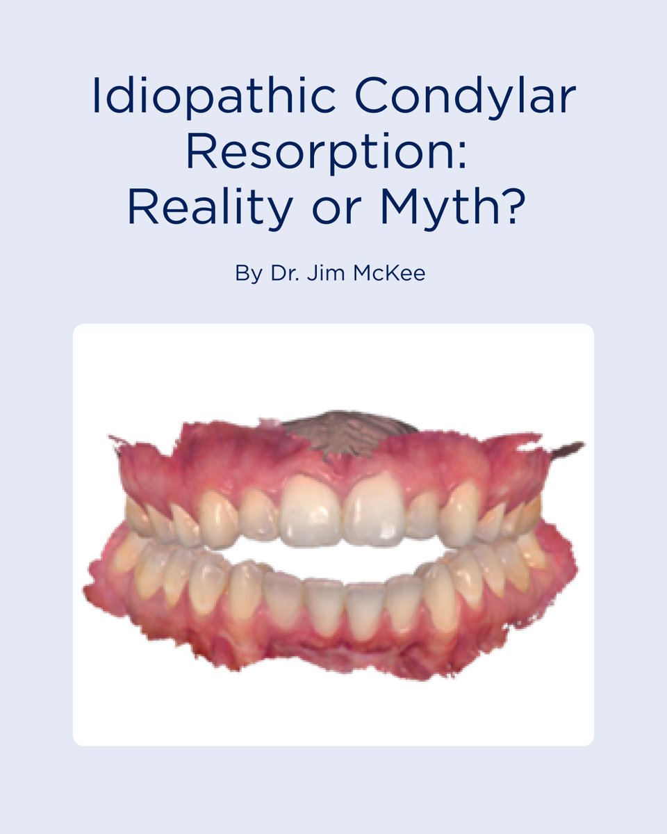 ICR isn’t “idiopathic” anymore. Decades of MRI &amp; CBCT research show TMJ disc displacement alters facial growth. Learn more about the topic in our latest Digest article. bit.ly/42outgu