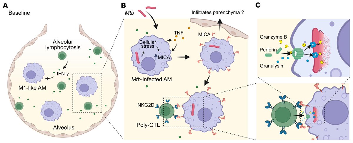 Journal of Clinical Investigation (@jclinicalinvest) on Twitter photo An exciting finding for the TB community!
<a href="/monica_sauer/">Monica Dallmann-Sauer</a> <a href="/easchurr/">Erwin Schurr</a> & team <a href="/RIMUHC1/">Research Institute of the MUHC (The Institute)</a> show people with HIV who are resistant to infection from Mycobacterium tuberculosis display activated alveolar macrophages & increased alveolar poly-cytotoxic T cells: jci.org/articles/view/… An exciting finding for the TB community!
<a href="/monica_sauer/">Monica Dallmann-Sauer</a> <a href="/easchurr/">Erwin Schurr</a> & team <a href="/RIMUHC1/">Research Institute of the MUHC (The Institute)</a> show people with HIV who are resistant to infection from Mycobacterium tuberculosis display activated alveolar macrophages & increased alveolar poly-cytotoxic T cells: jci.org/articles/view/…