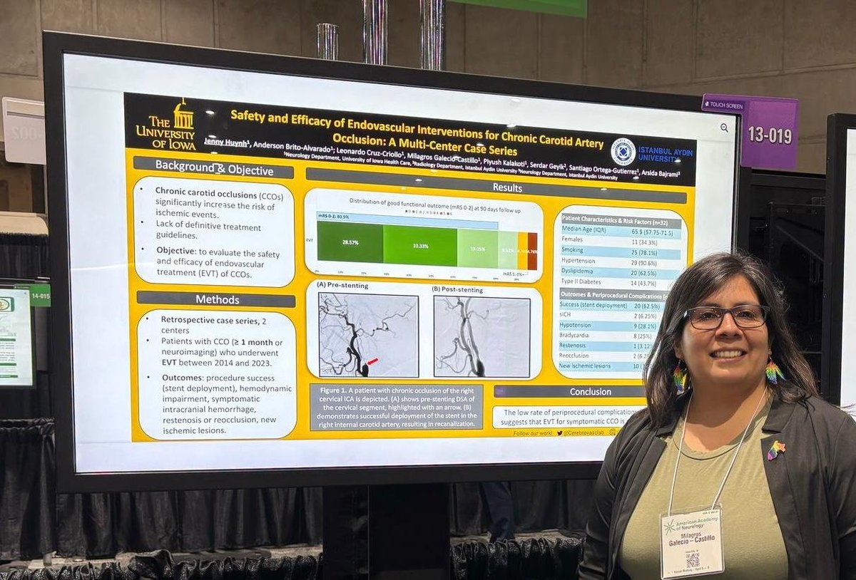 Cerebrovascular & Neurointerventional Lab (@cerebrovasclab) on Twitter photo Meanwhile at #AAN2025...
We are honored to have our Lab Manager, <a href="/mili_galecio/">Milagros Galecio-Castillo, MD</a> , representing our team with the presentation of our latest ePoster
🧠 “Safety and Efficacy of Endovascular Interventions for Chronic Carotid Artery Occlusion: A Multi-Center Case Series.”
With the Meanwhile at #AAN2025...
We are honored to have our Lab Manager, <a href="/mili_galecio/">Milagros Galecio-Castillo, MD</a> , representing our team with the presentation of our latest ePoster
🧠 “Safety and Efficacy of Endovascular Interventions for Chronic Carotid Artery Occlusion: A Multi-Center Case Series.”
With the