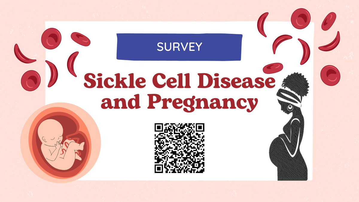Leila (@leila_sallie) on Twitter photo We invite healthcare professionals involved in the management of pregnant patients with sickle cell disease to share their insights and experiences in our survey. <a href="/eli_vlacho/">Evangelia Vlachodimitropoulou</a> <a href="/pshangaris/">Panicos Shangaris, PhD</a> <a href="/KCLredcell/">KCLredcell</a> <a href="/ElHoss_Sara/">Sara El Hoss</a> <a href="/JohnStrouboulis/">John Strouboulis</a> qualtrics.kcl.ac.uk/jfe/form/SV_bN… We invite healthcare professionals involved in the management of pregnant patients with sickle cell disease to share their insights and experiences in our survey. <a href="/eli_vlacho/">Evangelia Vlachodimitropoulou</a> <a href="/pshangaris/">Panicos Shangaris, PhD</a> <a href="/KCLredcell/">KCLredcell</a> <a href="/ElHoss_Sara/">Sara El Hoss</a> <a href="/JohnStrouboulis/">John Strouboulis</a> qualtrics.kcl.ac.uk/jfe/form/SV_bN…