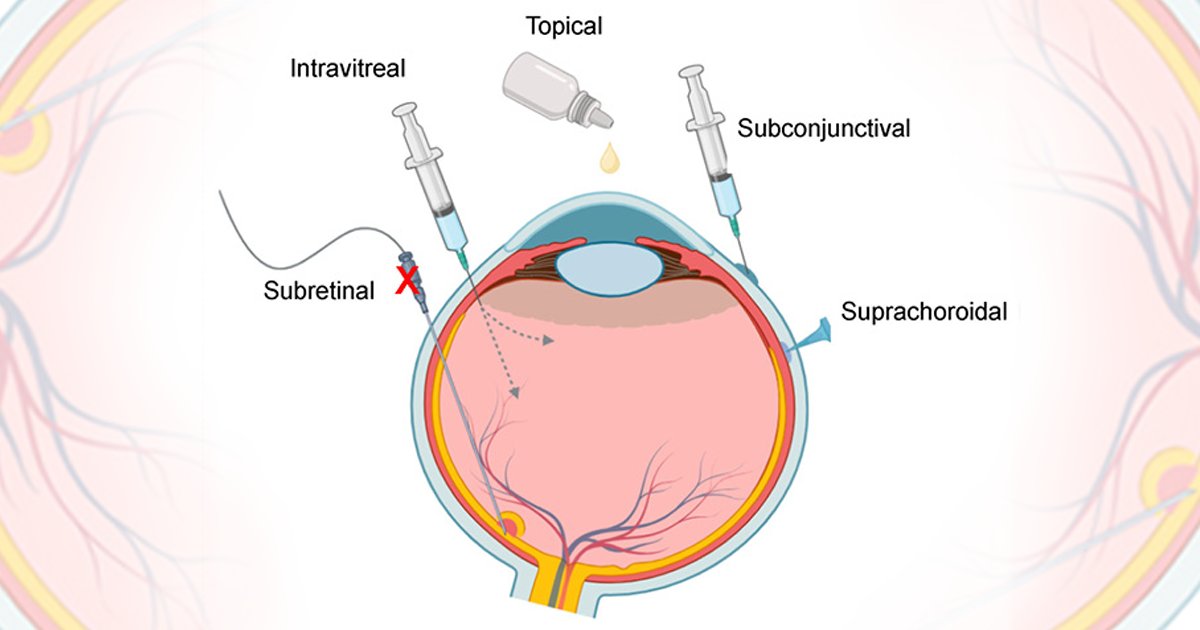 There's still time to claim your #CME credit with "Uveitic Macular Edema Therapy and Optimal Outcomes: It’s All in the Delivery!" on <a href="/RetinaCME/">RetinaCME</a> &gt;&gt; 

ow.ly/l6wv50Snj7h 

<a href="/LejlaVajzovic/">Lejla</a> <a href="/BauschLomb/">Bausch + Lomb</a>