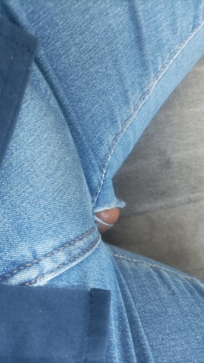 Es normal que se me rompa el pantalón así,
