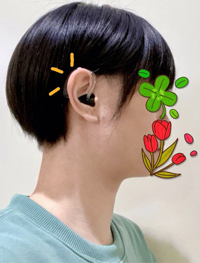 FSGS_kidney7's tweet photo. 《左の補聴器🦻現状》左耳は調整出来る限界まで音上げてる!左のみだと音は入って来ても…ただうるさいだけ。頭にキーン‼️と響く感じで全く意味をなしてない…💦右のみ補聴器🦻&両耳補聴器の聞こえにほぼ差がない!(音の方向が分かりやすいかな…程度💭)◀️そんな感じで左の補聴器の効果無いんです😓 https://t.co/kK5Yzr5aEP