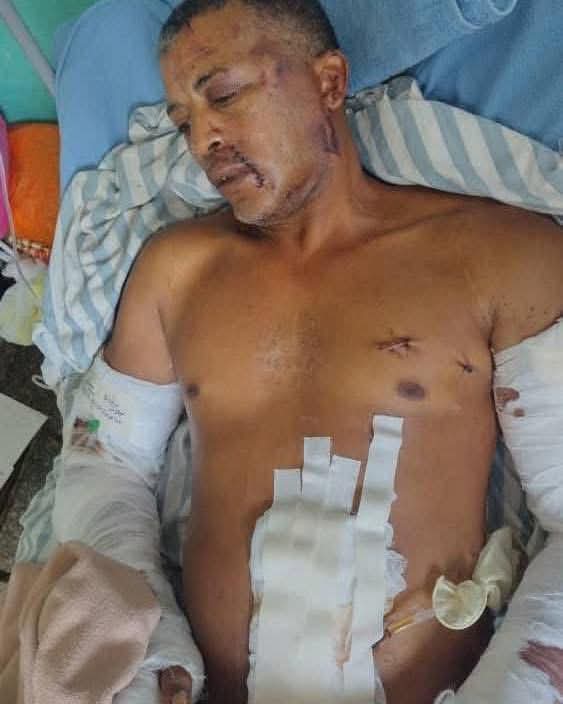 MercedesPerdig2's tweet photo. Pido una cadena de oracion por el hermano Juan Alberto de la Nuez Ramirez q fur brutalmente apuñalado y necesita  una segunda intervencion quirurgica valiente opositor de muchos años de lucha de verguenza y dignidad en contra de esa dictadura castrista.   ESTO ES TOO MUCH. https://t.co/QHJy298kpH