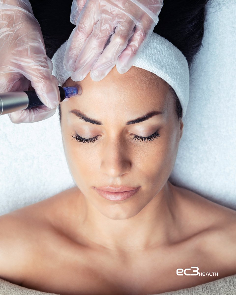 DavidCaddell3's tweet photo. 🌟 Skin Rejuvenation Just Leveled Up!
 
Combine Vive Exosome Therapy with microneedling for glowing, youthful skin. Enhance collagen, reduce wrinkles, and improve texture—all at once. Ready to offer the best in skin revitalization?

#ViveExosomes #Microneedling #EC3Health https://t.co/Oo2T5b6UrB