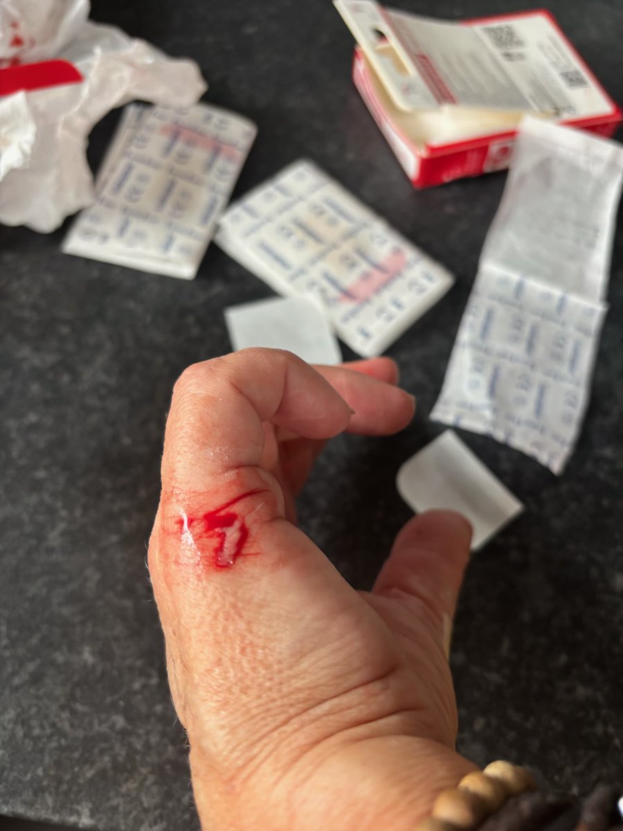 deekybloke's tweet image. @asda you may want to take these glasses off the shelf. Look at the damage an unbroken one did to my wife’s hand whilst washing.  No breaks or chips, the rims are too sharp and dangerous!!!