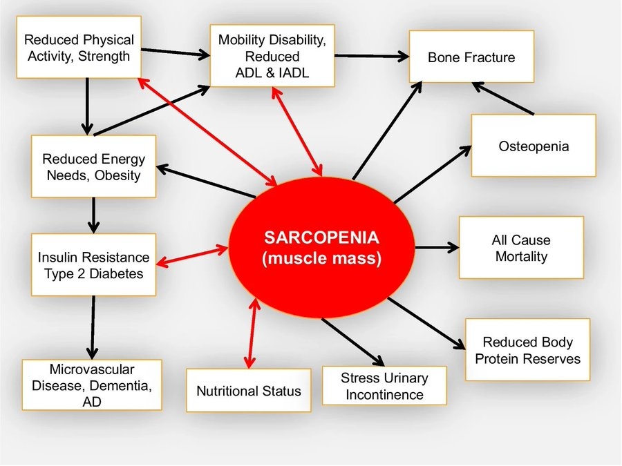 IntraMedNet's tweet image. 👉 El músculo es el principal destino de la glucosa inducida por insulina y clave en el metabolismo basal.

⚠️ Su pérdida (masa y fuerza) es una consecuencia crítica de enfermedades crónicas y un factor de riesgo en sí misma.

#Sarcopenia #Medicina #SaludMetabólica