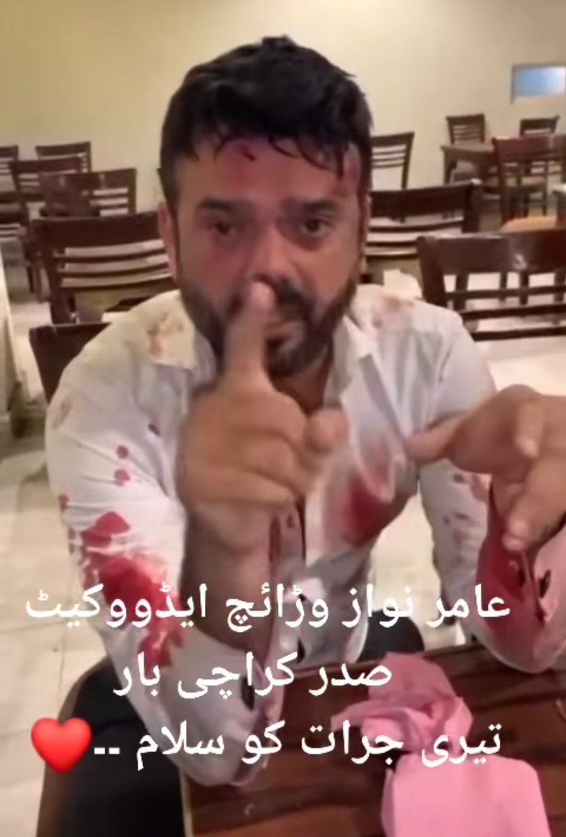 fahadali_butt's tweet photo. کراچی بار کے صدر عامر نواز وڑائچ پہ قاتلانہ حملے کی شدید الفاظ میں مذمت کرتے ہیں اور مقتدر حلقوں سے گزارش کرتا ہوں کہ قاتلانہ حملے میں ملوث شر پسند عناصر کی جلد گرفتاری عمل میں لائی جائے اور آن کے منحوس چہروں کو عوام کے سامنے بے نقاب کیا جائے۔
#stronglycondemned https://t.co/hFOpvyt1GG