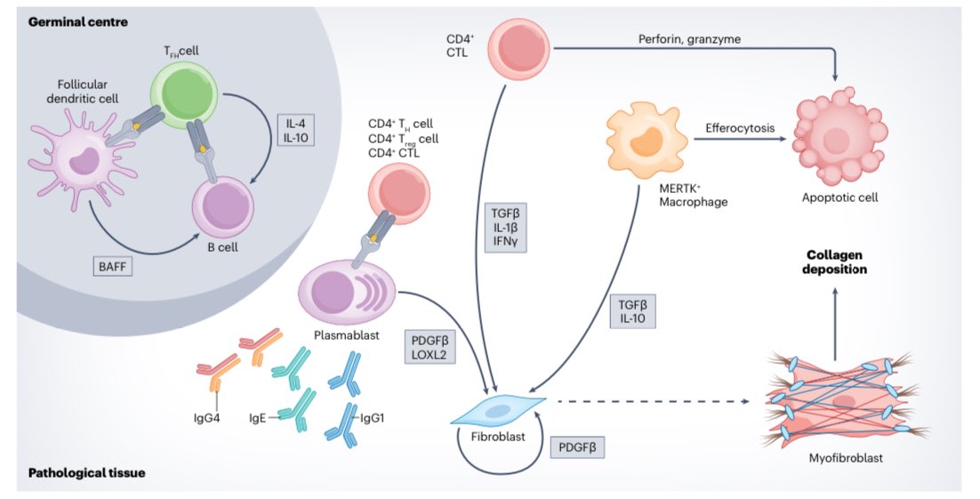 dr_immuno29's tweet photo. 🚨 Deep Dive into IgG4-Related Disease (IgG4-RD) from Nature Reviews Rheumatology!

•🌟 What is IgG4-RD? A sneaky fibro-inflammatory disorder hitting multiple organs with slow-growing, pseudo-tumoural lesions—think hidden troublemakers!
•⚠️ Diagnosis Challenge: No gold-standard criteria! Needs a detective-like approach—blend clinical signs, radiology, and serology to ditch mimics like histiocytoses, vasculitis, and lymphoproliferative disorders.
•🎯 Subphenotypes: Spot the variety—Mikulicz (swollen glands), head-neck limited, pancreato-hepato-biliary (jaundice alert!), retroperitoneal/aortic—each with unique patient profiles, symptoms, and IgG4 levels!
•💊 Treatment: Glucocorticoids lead the charge, but B cell-depleting champs (rituximab, inebilizumab) and cytokine-targeting drugs are stealing the spotlight—most still in hot clinical trials!
•🔄 Chronic Nature: A relapsing rogue—demands vigilant, long-term follow-up to keep it in check!
•📊 Fun Fact: Hits men harder (2:1-3:1 ratio) with a vascular vibe—50% cases show large/medium artery involvement, even small vessels!
•🕵️ History Bite: Born in 2001 with autoimmune pancreatitis link—evolved into a systemic puzzle by 2003, tying sclerosing pancreatitis, Riedel thyroiditis, and more!
•🩺 Symptoms Spotlight: Jaundice, proptosis, abdominal pain, or cranial neuropathies—depends on the organ hit, making it a diagnostic rollercoaster!
•🔬 Histology Clue: Fibrosis + chronic inflammation = IgG4-RD signature—seen on FDG-PET-CT for activity tracking!
•🌐 Research Edge: Ongoing trials push boundaries with monoclonal antibodies—stay tuned for breakthroughs!
#IgG4RD #Rheumatology #AutoimmuneDisease #MedicalResearch #HealthInnovation #RareDisease #ClinicalTrials
 https://t.co/bgqYTrDeZn