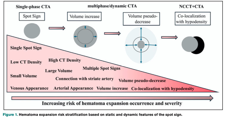 Umberto Pensato 🇮🇹 🇨🇦 (@upensato) on Twitter photo Our latest review on Spot Sign in Intracerebral Hemorrhage is available on #Stroke. #SpotSign is coming back! <a href="/johanna_ospel/">Johanna Ospel, MD PhD</a> <a href="/American_Heart/">American Heart Association</a> <a href="/StrokeAHA_ASA/">Stroke AHA/ASA</a> <a href="/HumanitasMilano/">Humanitas Milano</a> <a href="/DCNSNeuro/">DCNS Calgary</a>
ahajournals.org/doi/10.1161/ST… Our latest review on Spot Sign in Intracerebral Hemorrhage is available on #Stroke. #SpotSign is coming back! <a href="/johanna_ospel/">Johanna Ospel, MD PhD</a> <a href="/American_Heart/">American Heart Association</a> <a href="/StrokeAHA_ASA/">Stroke AHA/ASA</a> <a href="/HumanitasMilano/">Humanitas Milano</a> <a href="/DCNSNeuro/">DCNS Calgary</a>
ahajournals.org/doi/10.1161/ST…