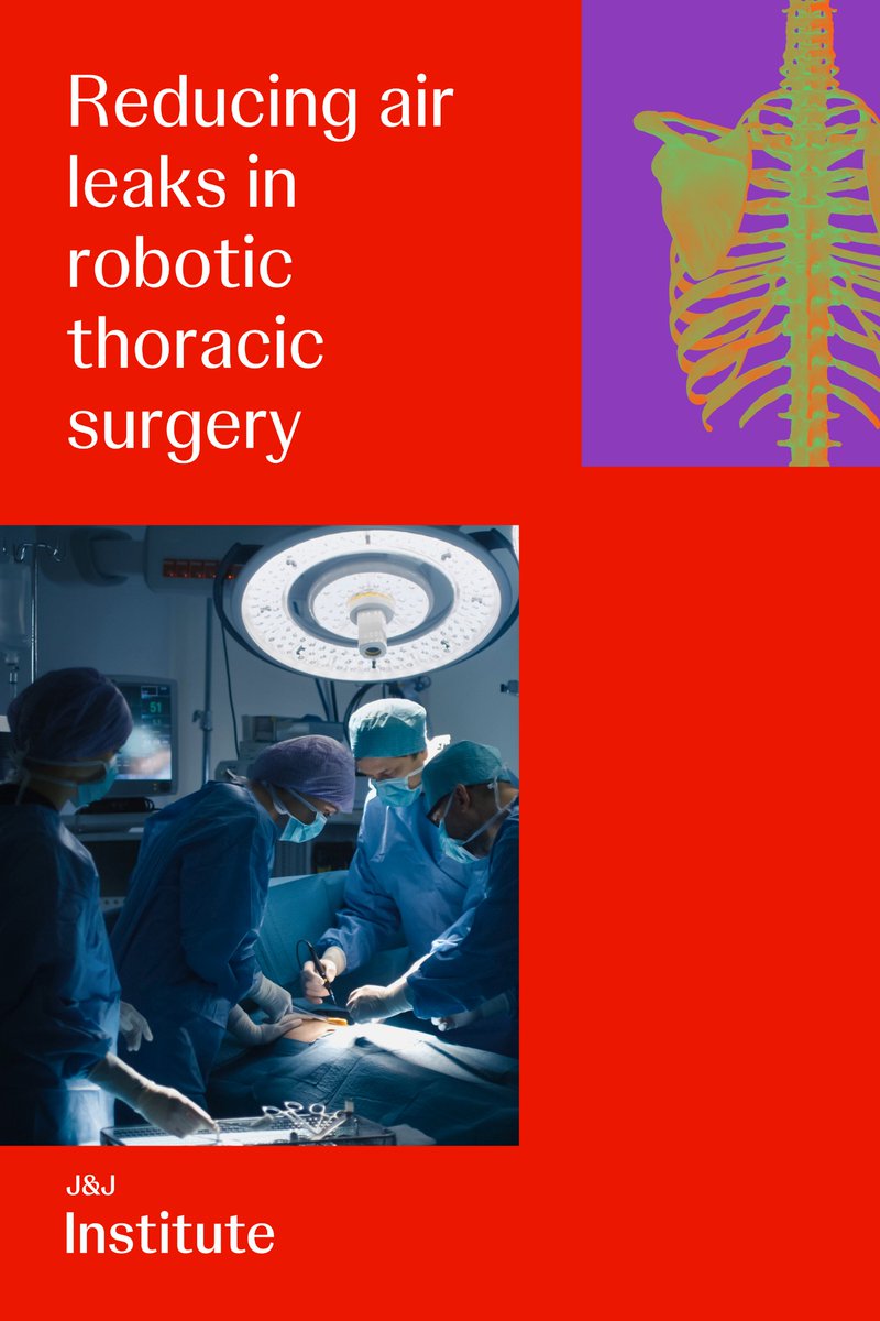 JNJMedTech's tweet photo. Post-operative air leaks can be a challenge in lung resection surgery. Watch as Dr. Emily Cassidy shares insights on key considerations for minimizing risks in robotic thoracic procedures: https://t.co/WkXYDk0fit
#LungResection #ThoracicSurgery #RoboticSurgery #JNJInstitute https://t.co/gBbSl11aPu