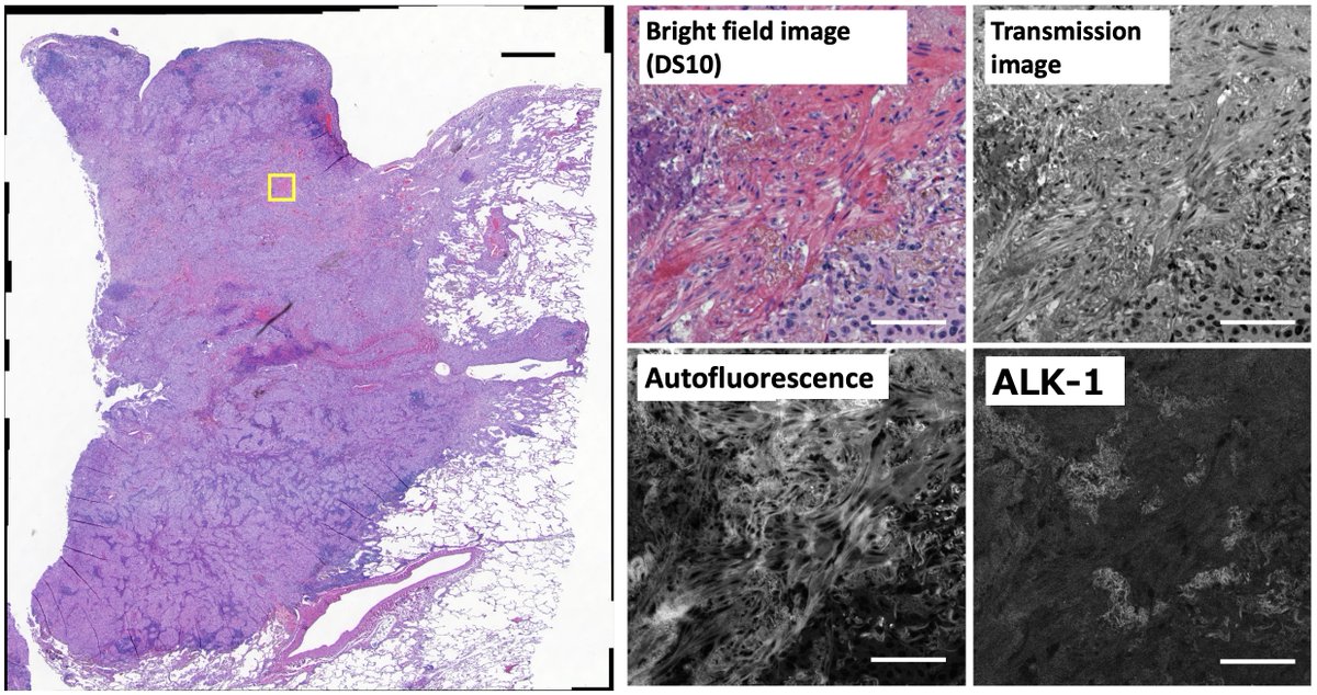 NikonInst's tweet photo. 🔬 Our #Microscopy #AppNote shows how to avoid #Fluorescence crosstalk from H&amp;E staining via near-infrared #NIR fluorescence imaging, demonstrated using a microscope equipped with both our Digital Sight 10 color camera and AX / AX R #Confocal system: https://t.co/HhpgFJMc3o https://t.co/OSAlEl4IfU