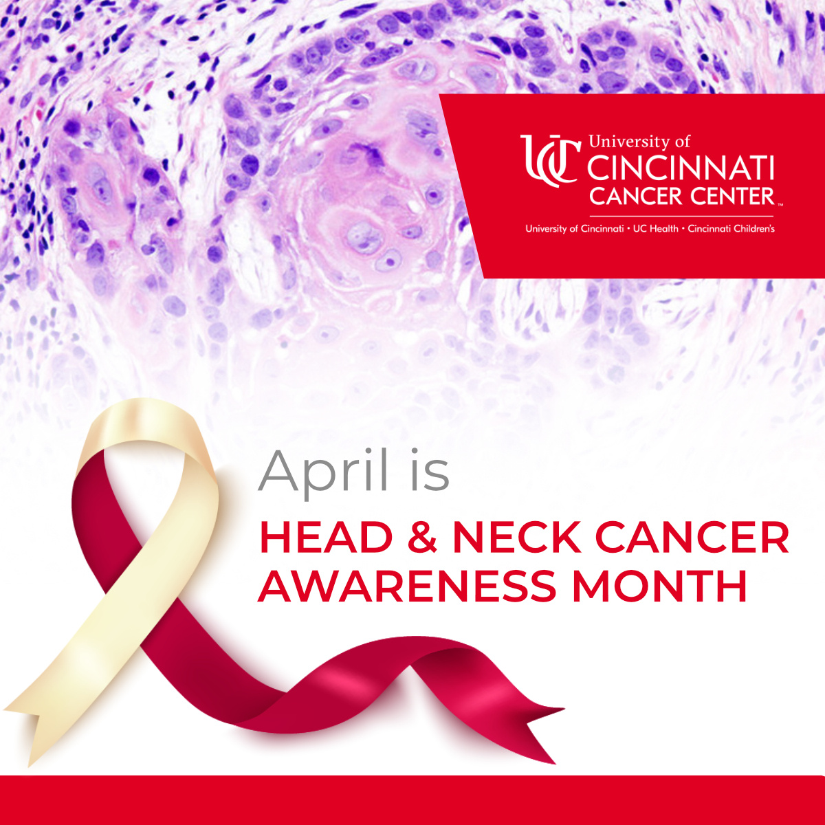 Head and neck cancer is the 5th most common cancer in our catchment area, with risk factors including tobacco, alcohol, HPV, and EBV. Early symptoms are often subtle. Stay tuned this month as we highlight Cancer Center research advancing understanding and care.