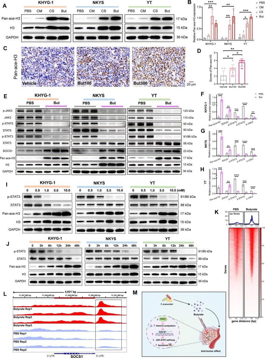 Gut_BMJ's tweet photo. #GUTImages from the paper by Shi et al on
"Butyrate-producing Faecalibacterium prausnitzii suppresses natural killer/T-cell lymphoma by dampening the JAK-STAT pathway" via
https://t.co/apGovk3iV3
#JAKSTAT #Microbiota https://t.co/74nv1Loyyr