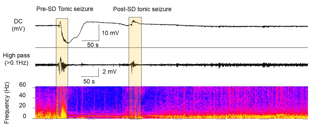 Brain1878's tweet image. Aiba et al. identify bilateral cortical spreading depolarization in a mouse model of epilepsy linked to a sodium channel mutation. Targeting persistently open ion channels pharmacologically could help mitigate this newly discovered disease mechanism. tinyurl.com/ey2ca956