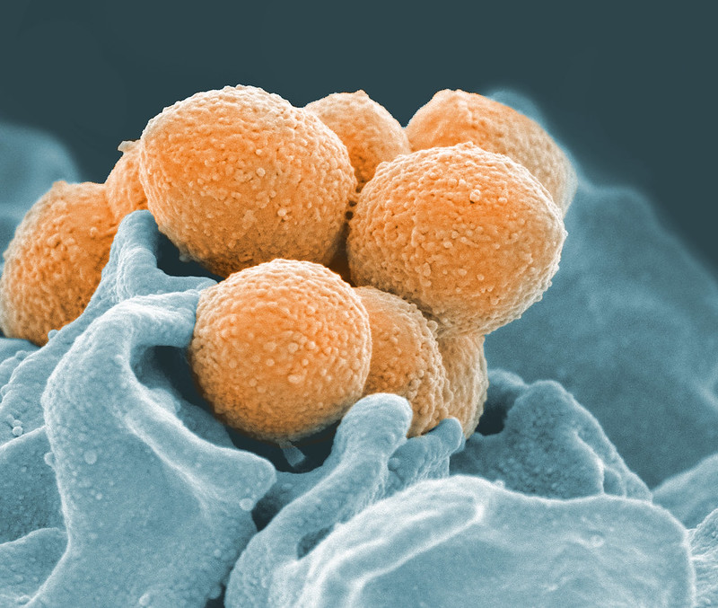 CIDRAP's tweet photo. CDC study finds substantial US increase in invasive group A strep infections
A surveillance study of 10 US states shows incidence of invasive group A Streptococcus infections more than doubled from 2013 through 2022.
https://t.co/juBRrI2keY
Photo Credit: NIAID / Flickr cc https://t.co/IWZjb3jHPa