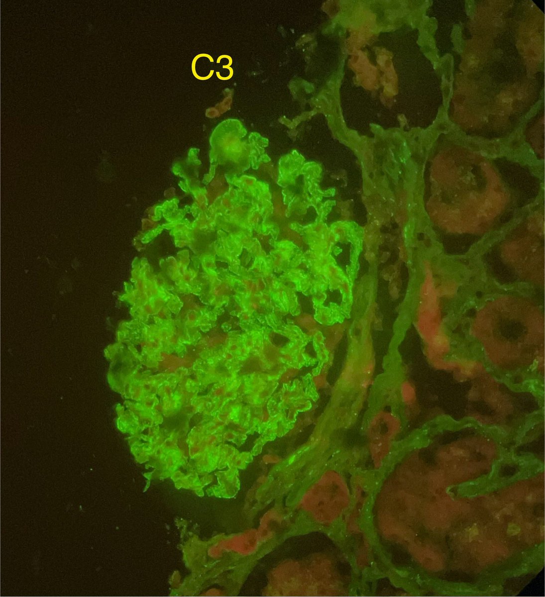 Nate_path's tweet image. Never seen the show, but I guess I have to watch it now! #PathX #Nephropath #Renalpath #Nephrology