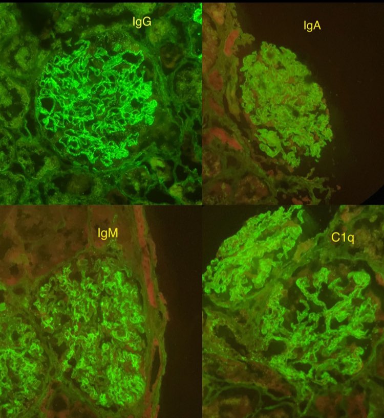 Nate_path's tweet image. Never seen the show, but I guess I have to watch it now! #PathX #Nephropath #Renalpath #Nephrology