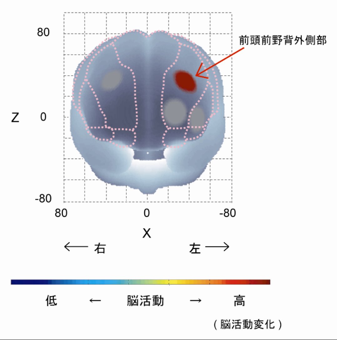 tera_mental_pt's tweet photo. 特に左前頭前野背外側部(ストルーブ課題時)。ワーキングメモリに関与し、日常生活での意思決定や問題解決、社会的に必要な自己制御において非常に重要な場所。ややきつめの運動によって、こうした脳機能をブーストできる。 https://t.co/i9vwaikRUi