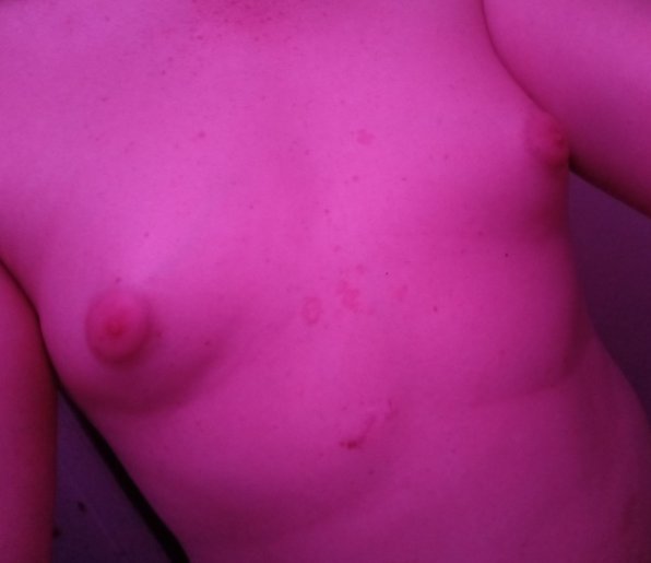 VioletSecrets94's tweet photo. Sorry if this isn't the best place to post but I'm desperate. Does anybody know a reliable HRT seller?
My insurance doesn't cover it. I was getting it through a friend however, they are no longer selling.
I've actually been making decent progress and I don't want to lose it. https://t.co/jjYUEIYVKm