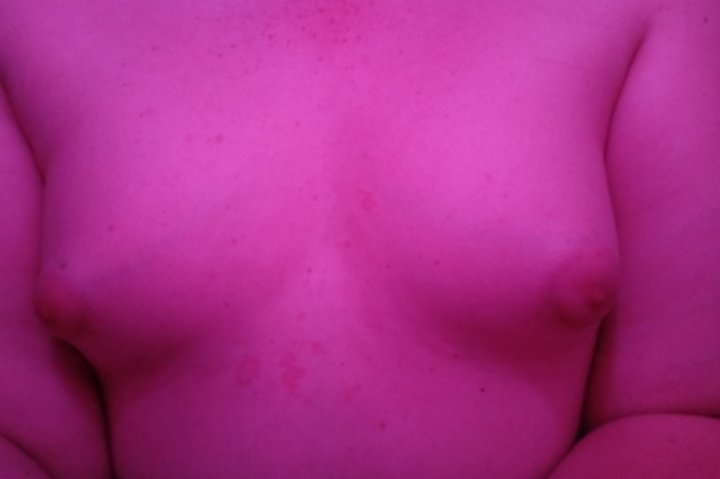 VioletSecrets94's tweet photo. Sorry if this isn't the best place to post but I'm desperate. Does anybody know a reliable HRT seller?
My insurance doesn't cover it. I was getting it through a friend however, they are no longer selling.
I've actually been making decent progress and I don't want to lose it. https://t.co/jjYUEIYVKm