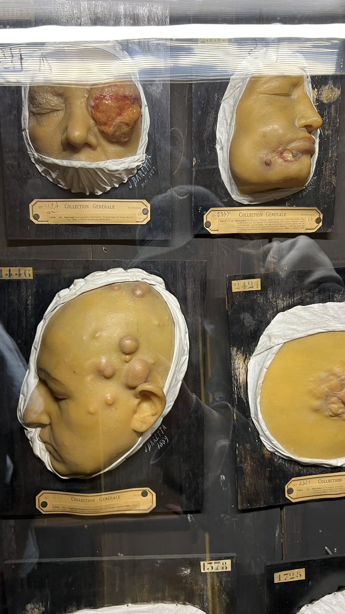 Teti💙💛 (@spasi___sohrani) on Twitter photo I just visited the Museum of Diseases today. inspired 😂 I just visited the Museum of Diseases today. inspired 😂