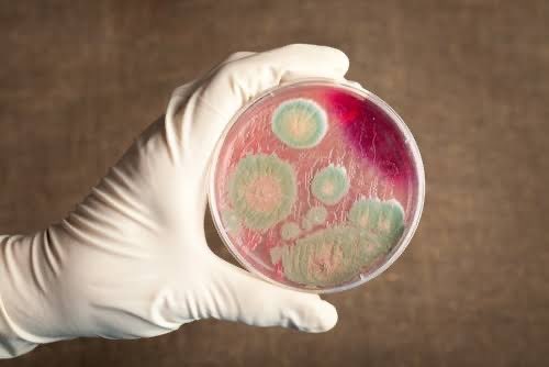 valiisaa's tweet photo. Tau penyakit Anthrax? Penyebabnya si Bacillus anthracis

Kita bahas si penyebab penyakit ini ya. Kita dive nih soal si Bacillus anthracis, bakteri yang bikin orang takut karena dia dalangnya penyakit antraks. 

Bakteri ini emang bukan main-main, tipe yang hardcore abis. Dia termasuk kelompok bakteri gram-positif, bentuknya kayak batang panjang, dan punya kemampuan spesial bisa bikin spora. 

Spora ini bikin dia tahan banting banget, bisa bertahan di tanah, debu, atau lingkungan ekstrem selama puluhan tahun, nunggu kesempatan buat aktif lagi.