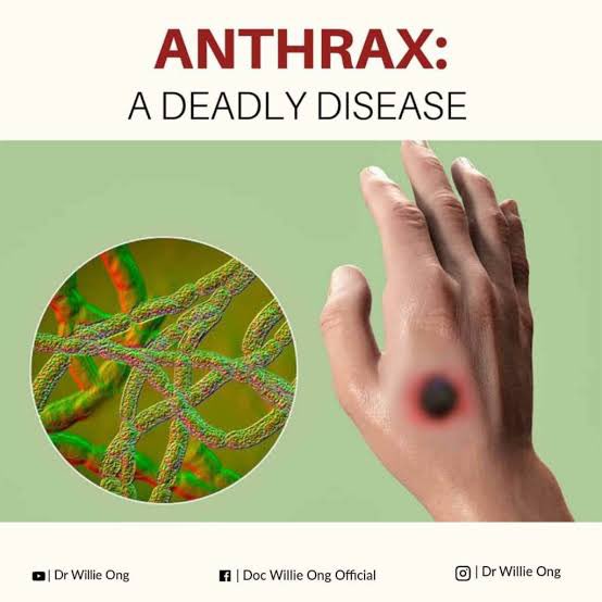 valiisaa's tweet photo. Tau penyakit Anthrax? Penyebabnya si Bacillus anthracis

Kita bahas si penyebab penyakit ini ya. Kita dive nih soal si Bacillus anthracis, bakteri yang bikin orang takut karena dia dalangnya penyakit antraks. 

Bakteri ini emang bukan main-main, tipe yang hardcore abis. Dia termasuk kelompok bakteri gram-positif, bentuknya kayak batang panjang, dan punya kemampuan spesial bisa bikin spora. 

Spora ini bikin dia tahan banting banget, bisa bertahan di tanah, debu, atau lingkungan ekstrem selama puluhan tahun, nunggu kesempatan buat aktif lagi.