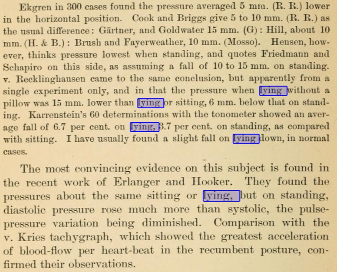 Theodore Janeway (my residency firm's namesake) grappling with body position and BP differences in 1904! These questions remain unanswered...
#OslerPride