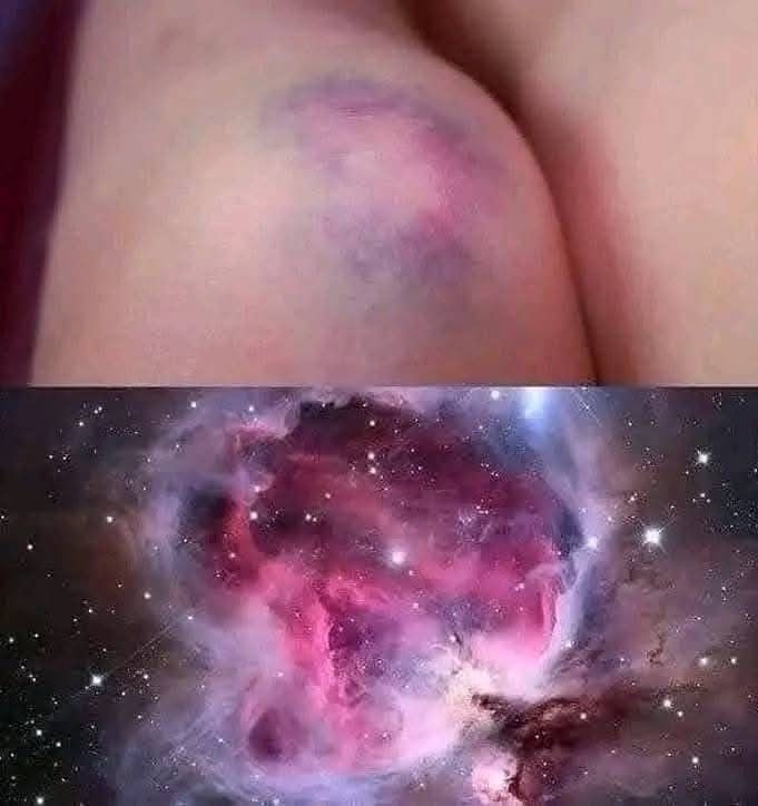 I love getting bruses so much man LOOK AT THE COMPARISON