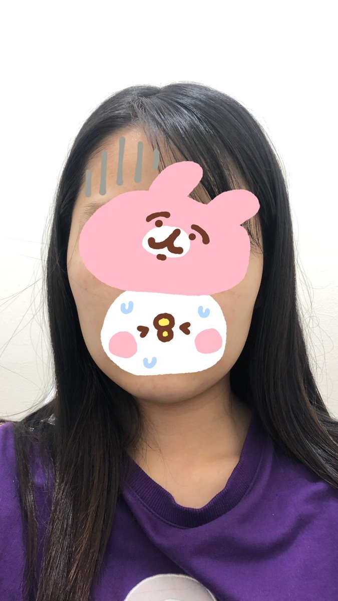 iadd77's tweet photo. 輪郭3点約DT11ヶ月目✨️2枚目の骨切り前、顔ボコボコすぎる笑😇 https://t.co/5aD91MNfc7