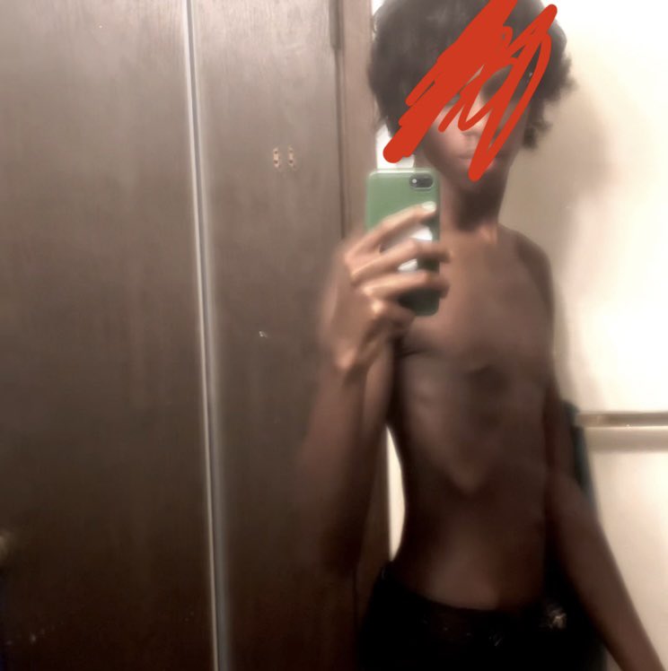 kittyramirez's tweet image. Me vs my thinspo