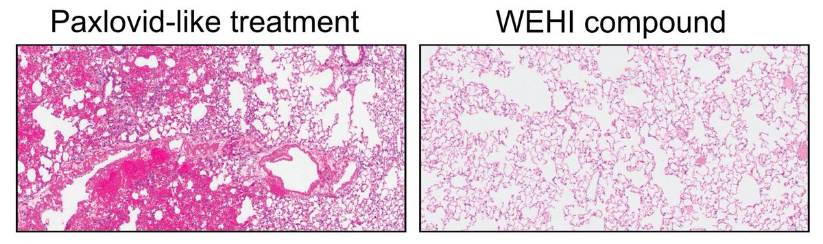 vipintukur's tweet photo. While currently approved therapies for COVID-19 like Paxlovid target a critical coronavirus protein known as Mpro, WEHI researchers identified another protein, termed #PLpro, the essential coronavirus protease as a promising drug target in 2020. 4/ https://t.co/JBWVhsOXep