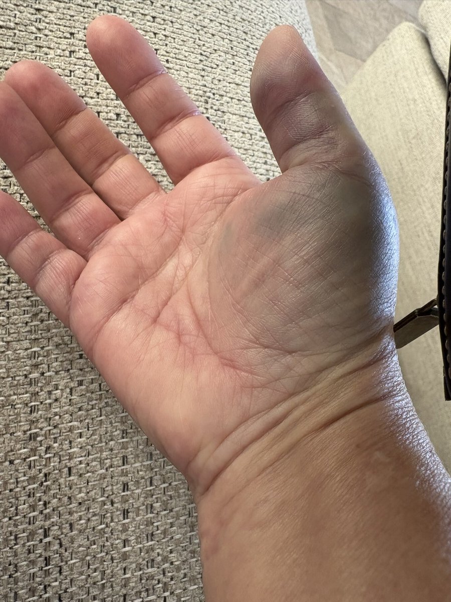 julie la résiliente . ben oui ! tweet media