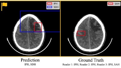 Radiology: Artificial Intelligence (@radiology_ai) on Twitter photo <a href="/ShahriarFaghani/">Shahriar Faghani MD</a> <a href="/Slowvak/">Brad Erickson</a> propose a method to increase trust in medical #DeepLearning tools doi.org/10.1148/ryai.2… <a href="/MayoRadiology/">Mayo Clinic Radiology</a> #brain #XAI #MachineLearning <a href="/ShahriarFaghani/">Shahriar Faghani MD</a> <a href="/Slowvak/">Brad Erickson</a> propose a method to increase trust in medical #DeepLearning tools doi.org/10.1148/ryai.2… <a href="/MayoRadiology/">Mayo Clinic Radiology</a> #brain #XAI #MachineLearning
