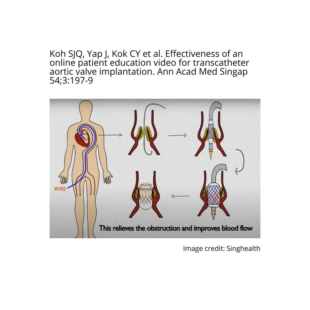 How can online video improve TAVI patient prep? 🤔 This research from Annals of Academy of Medicine, Singapore investigates! Article: 
doi.org/10.47102/annal…
#Cardiology #PatientOutcomes #DigitalHealth
