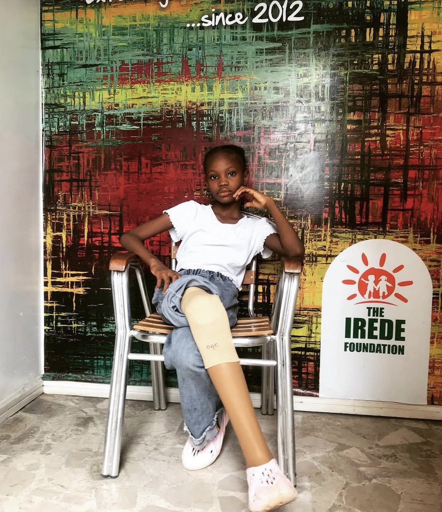 Losing a limb doesn’t mean losing purpose.
This month, we honor strength, adaptability, and courage.

…
Join us to walk 12th April, 2025:
ooal.theiredefoundation.org
#LLAM #LimbLossAwareness