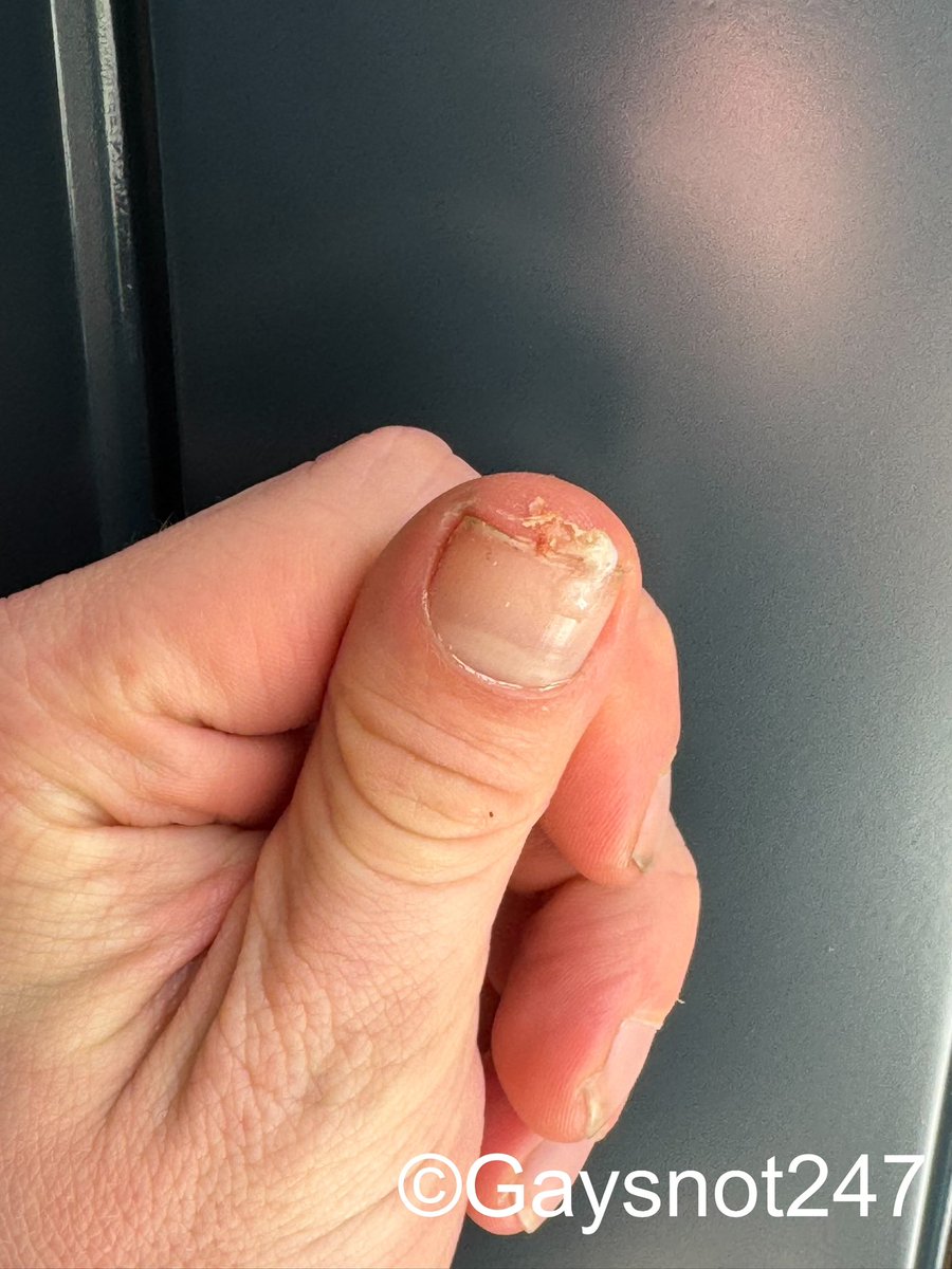 gaysnot247's tweet photo. Scraped this crunchy, gooey booger out of my nose yesterday. The pollen is making my nose runny every two seconds. π€§ #snot #gay #gaysnot #boogers #nose #malenose #nostrils #snoteater #boogereater #gaypig #pig #nosefetish #snotfetish https://t.co/h30bce1r2D