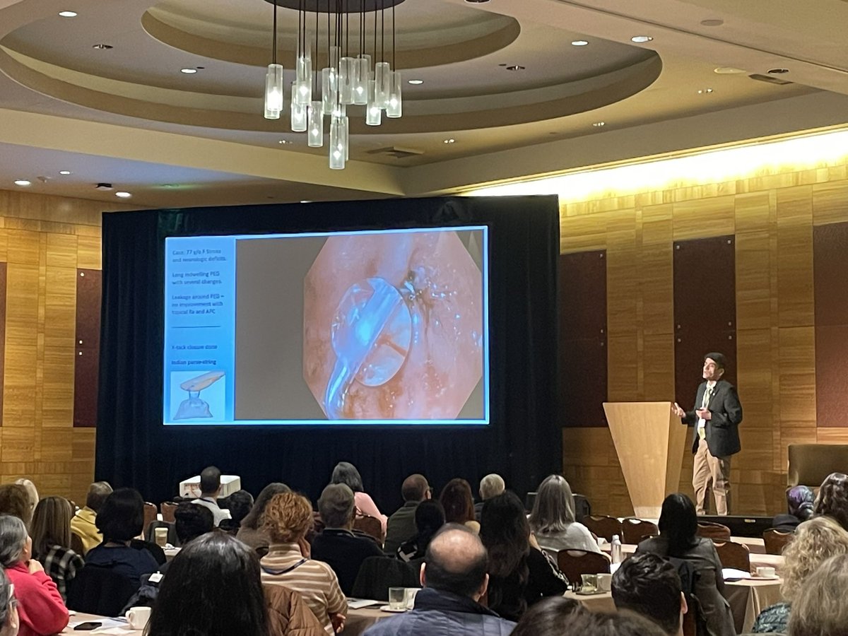 Mohit Girotra, MD, AGAF, FASGE, FACG, FACP (@mohitgirotra) on Twitter photo 3/29/2025: It was an honor and privilege to have presented “Upper GI Video Series” at recent Pacific Northwest GI Society biennial conference.
I highlighted UGI clinical scenarios utilizing Cryotherapy, Cellvizio, LAMS & Endoscopic suturing.
<a href="/FITE_endoscopy/">FITE - Foundation</a>
<a href="/ProvSwedish/">Providence Swedish</a> 3/29/2025: It was an honor and privilege to have presented “Upper GI Video Series” at recent Pacific Northwest GI Society biennial conference.
I highlighted UGI clinical scenarios utilizing Cryotherapy, Cellvizio, LAMS & Endoscopic suturing.
<a href="/FITE_endoscopy/">FITE - Foundation</a>
<a href="/ProvSwedish/">Providence Swedish</a>