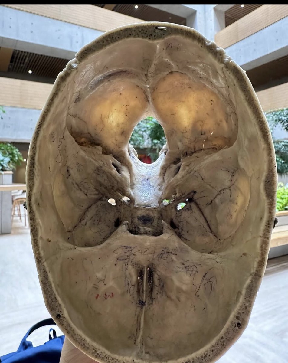 The toughest bone to discuss in human anatomy🤲🥹

If you meet this Bone on Anatomy viva ehhh…It’s gone!!!(otilo)