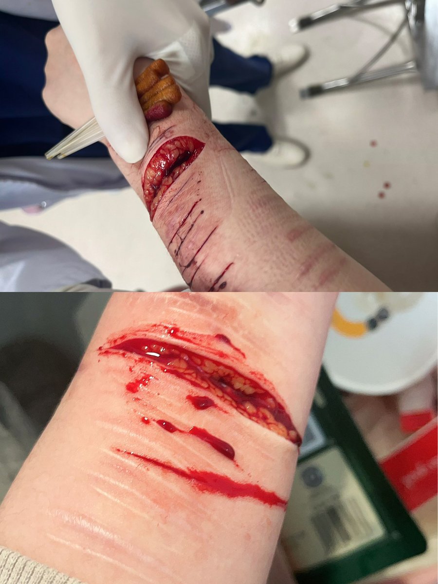 我是耐耐腐 想和有趣的人做朋友 
偶尔会割手但是经常od
接线上线下 价格可以私我
喜欢我可以给我打钱💕
可以和我互fo互转吗🥹