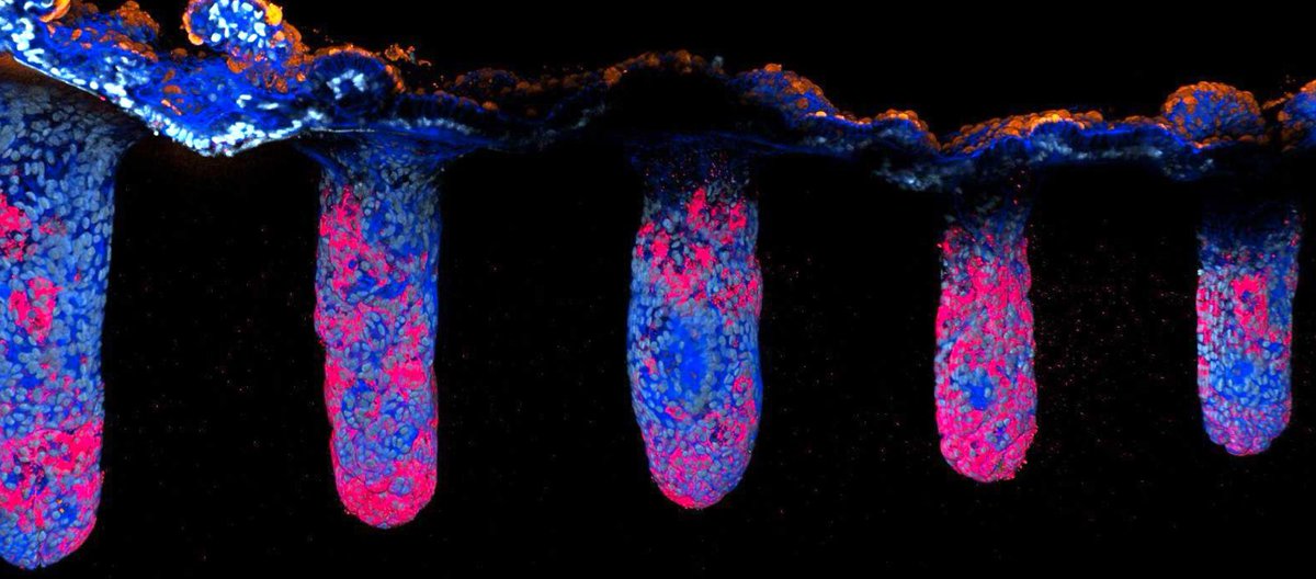 Joep Beumer (@beumerjoep) on Twitter photo We are searching for 2 talented MSc students to join the group! If you are interested in using advanced organoid models to study regulators of intestinal differentiation or nutrient uptake, please apply! go.roche.com/skt2b and go.roche.com/wf7hj
<a href="/IHB_Research/">Institute of Human Biology</a> We are searching for 2 talented MSc students to join the group! If you are interested in using advanced organoid models to study regulators of intestinal differentiation or nutrient uptake, please apply! go.roche.com/skt2b and go.roche.com/wf7hj
<a href="/IHB_Research/">Institute of Human Biology</a>