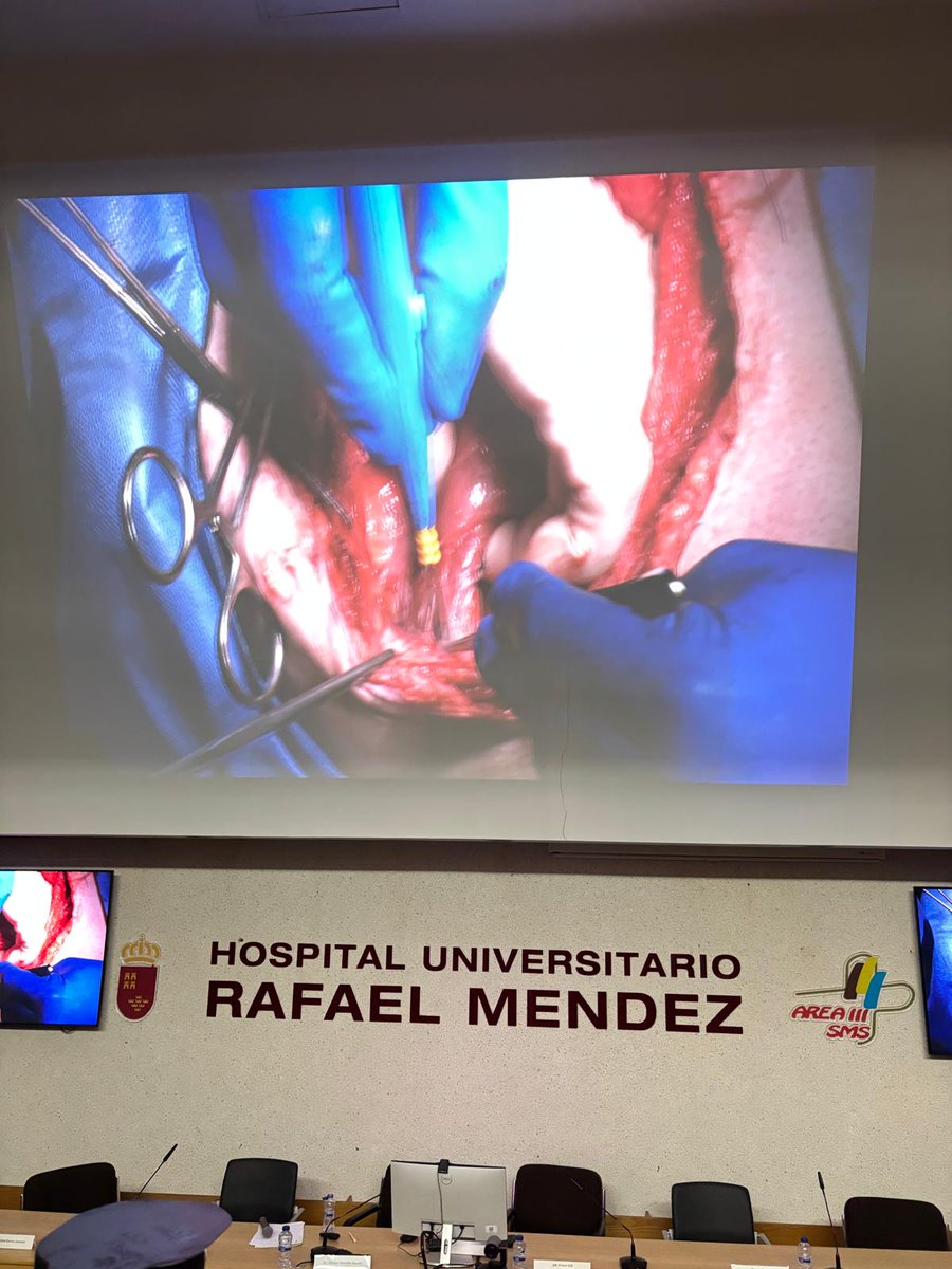 Area 3 Salud Lorca (@area3lorca) on Twitter photo 📍 Hoy se ha celebrado en el @area3lorca el Workshop de Cirugía de Pared Abdominal Compleja en el H.U. Rafael Méndez, con cirugía en directo y participación de especialistas regionales y nacionales.
🙏 Enhorabuena y agradecimiento a los profesionales implicados <a href="/Murciasalud/">Murciasalud</a> 📍 Hoy se ha celebrado en el @area3lorca el Workshop de Cirugía de Pared Abdominal Compleja en el H.U. Rafael Méndez, con cirugía en directo y participación de especialistas regionales y nacionales.
🙏 Enhorabuena y agradecimiento a los profesionales implicados <a href="/Murciasalud/">Murciasalud</a>