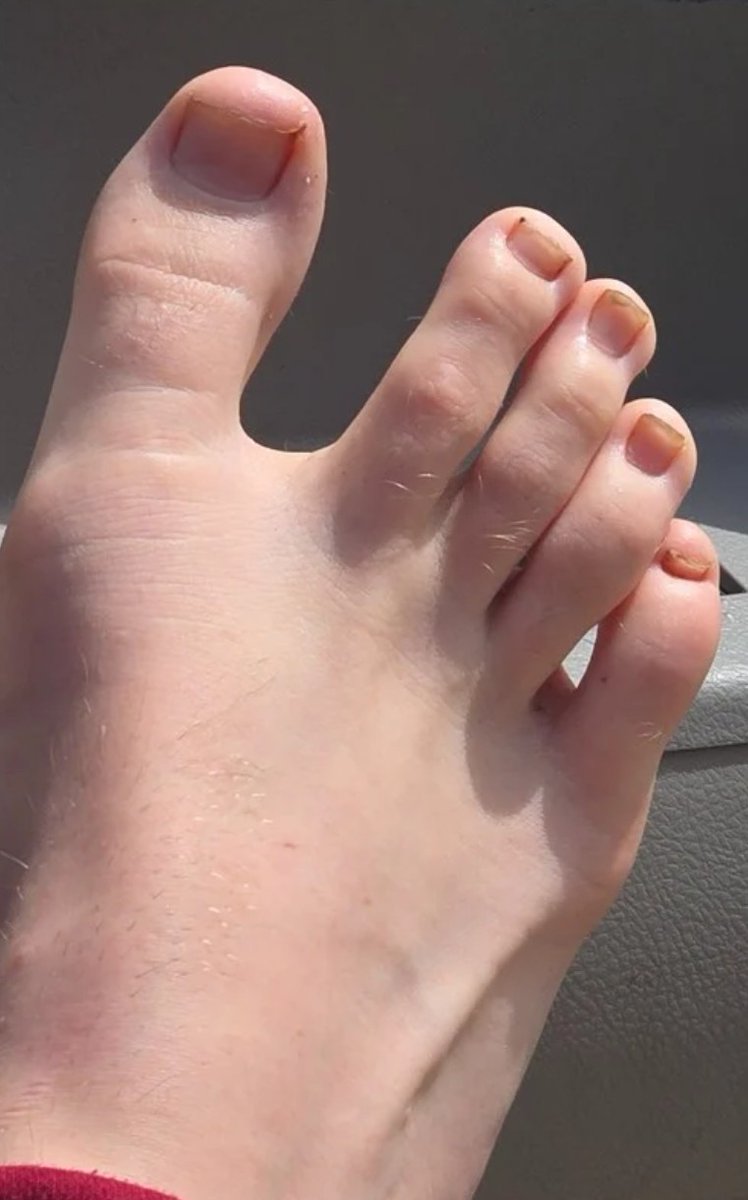 RileyMae56's tweet photo. @Big_Gothic_feet Hi, my name is Riley may and I am. Selling feet pictures and trying to break into the industry. If you're interested in why I will be posting  please consider giving me a follow. https://t.co/NrUpWf3TQt