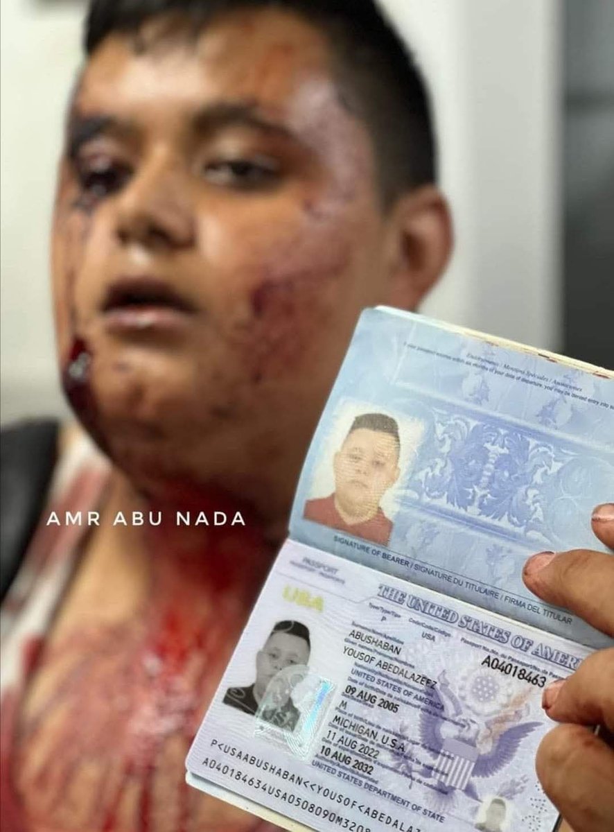 ThabitAhmd's tweet photo. American citizens are protected by the U.S. government wherever they are, except in Gaza.
#Gazagenocide #GazaUnderaAttack #IsraelFightsBack #IsraeliWarCrimes #Gaza
#us https://t.co/2FTMZzGBTa