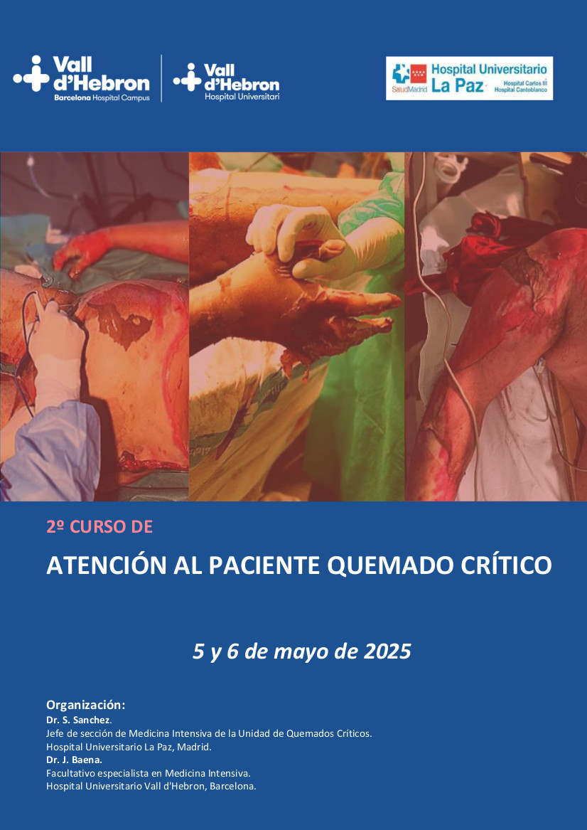 SEMICYUC (@semicyuc) on Twitter photo Este 5 y 6 de mayo se celebra en el Hospital Univ. Vall d'Hebron (Barcelona) la segunda edición del Curso de Atención al Paciente Quemado Crítico, una actividad que cuenta con el aval del Comité Científico de la SEMICYUC y de la <a href="/SOCMIC/">SOCMIC</a>. Inscripción con descuento para socios de Este 5 y 6 de mayo se celebra en el Hospital Univ. Vall d'Hebron (Barcelona) la segunda edición del Curso de Atención al Paciente Quemado Crítico, una actividad que cuenta con el aval del Comité Científico de la SEMICYUC y de la <a href="/SOCMIC/">SOCMIC</a>. Inscripción con descuento para socios de
