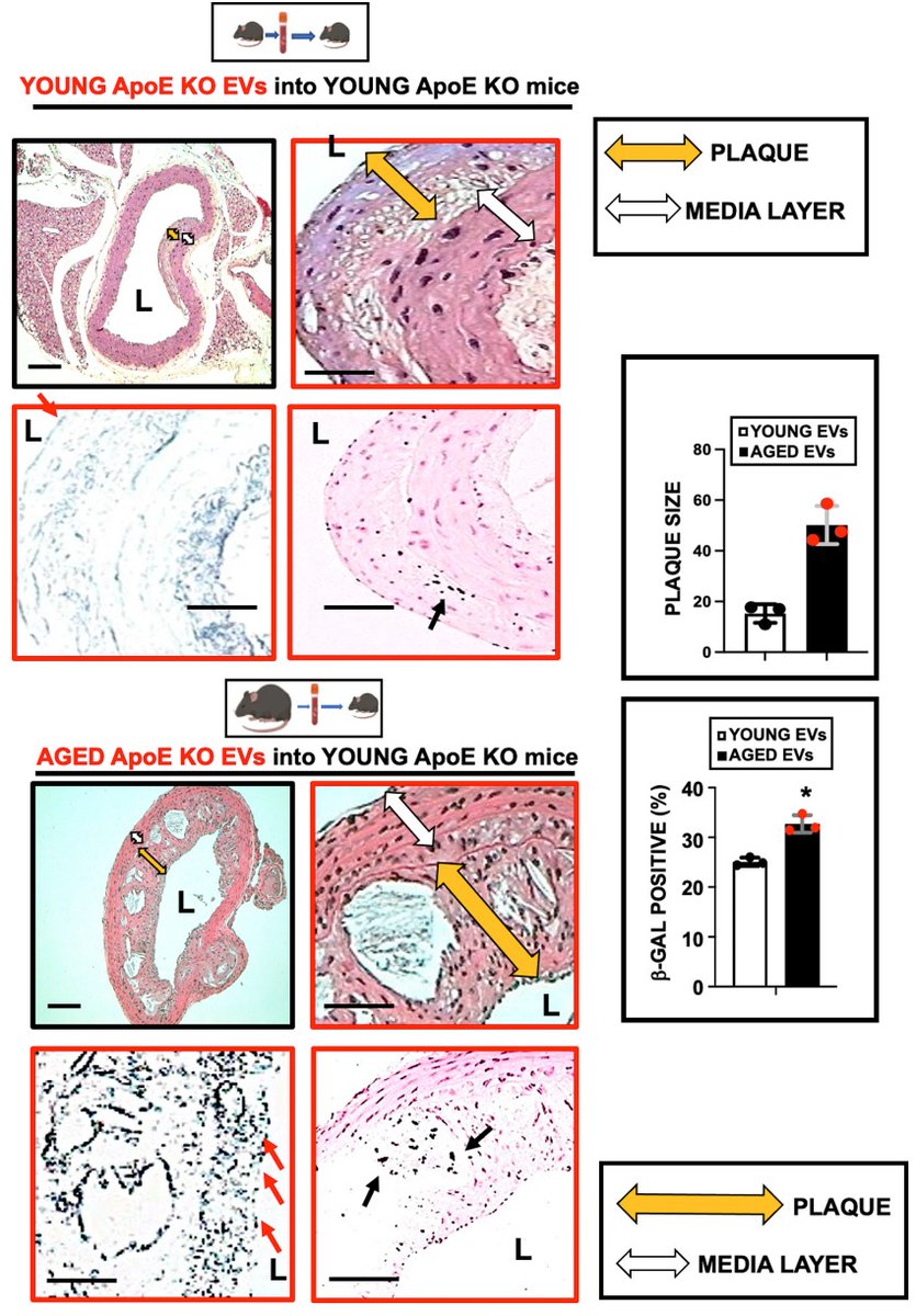 C.ZARAGOZA CARDIOMED (@cardiomedufv) on Twitter photo Excited to announce the release of our latest open-access publication <a href="/SpringerNature/">Springer Nature</a> #BiologyDirect. CAP1 as a novel marker of endothelial senescence in atherosclerosis, a prognostic marker of vascular aging <a href="/cardiomedufv/">C.ZARAGOZA CARDIOMED</a> , <a href="/UFVinvestiga/">Investigación UFV</a> , <a href="/UAHes/">Universidad Alcalá</a> #IRYCIS Excited to announce the release of our latest open-access publication <a href="/SpringerNature/">Springer Nature</a> #BiologyDirect. CAP1 as a novel marker of endothelial senescence in atherosclerosis, a prognostic marker of vascular aging <a href="/cardiomedufv/">C.ZARAGOZA CARDIOMED</a> , <a href="/UFVinvestiga/">Investigación UFV</a> , <a href="/UAHes/">Universidad Alcalá</a> #IRYCIS