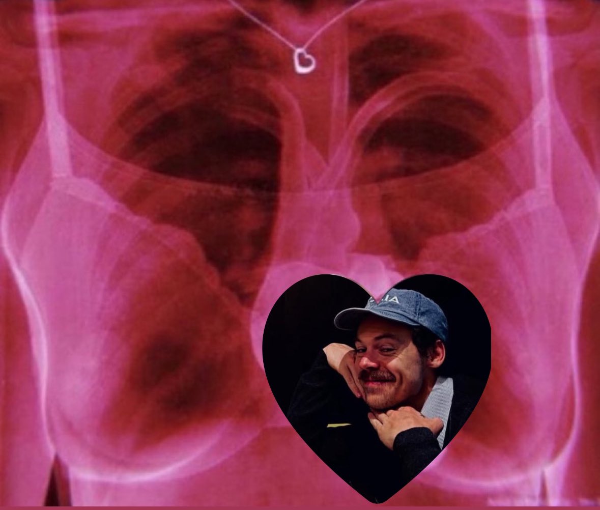 hrrylunaa's tweet image. 