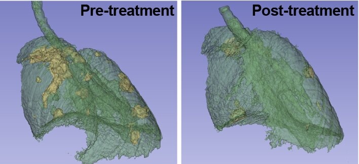 👩‍🔬 Identifican una nueva diana terapéutica para el cáncer de pulmón más frecuente

🦠La inhibición de una proteína clave en la señalización del crecimiento celular bloquea la progresión tumoral, según un estudio liderado por el #CSIC

👉tiny.cc/c1xf001